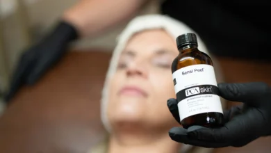 all about pca skin peels 6
