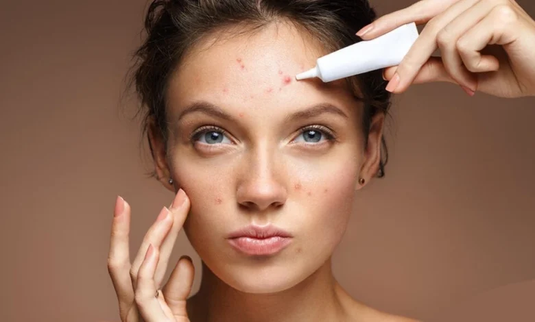 morning evening routine beat acne without medication 1۱