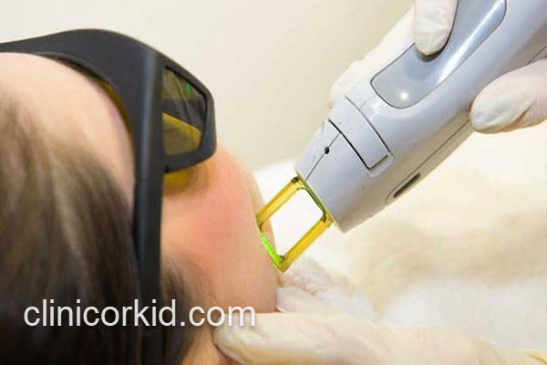 چرا انتخاب کلینیک مناسب برای انجام لیزر کندلا مهم است؟