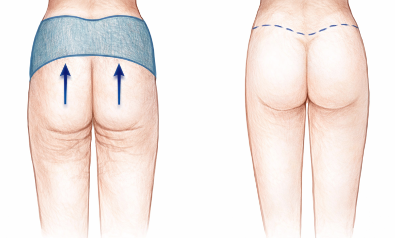 tZkGCVs1l4zdinnmAKdHNyIeHTaNlPik71ucKjKE