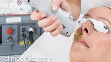 برای لیزر موهای زائد با دستگاه الکساندرایت کندلا در پونک کجا بریم؟