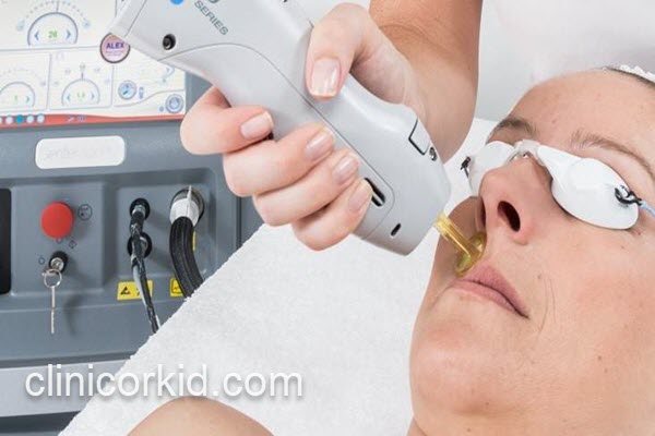 برای لیزر موهای زائد با دستگاه الکساندرایت کندلا در پونک کجا بریم؟