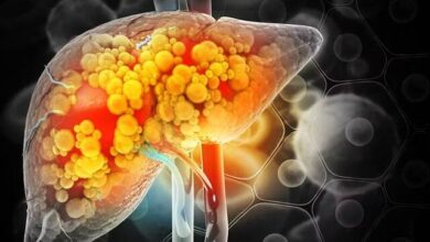 7fdf3ea8 45fd 431c 85b0 83c0d2a2d7c6