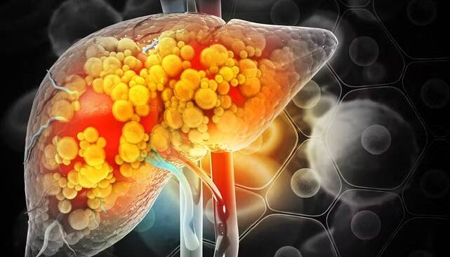 7fdf3ea8 45fd 431c 85b0 83c0d2a2d7c6