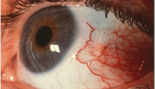 b3fa05f8 e9a4 4f4f 9781 7a4073334d68