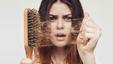 hair loss due to stress cyspersa