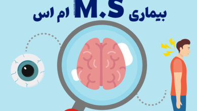 ام اس