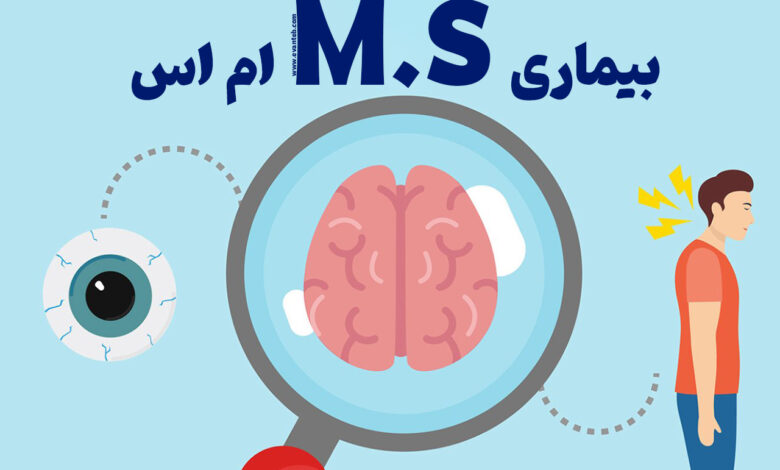 ام اس