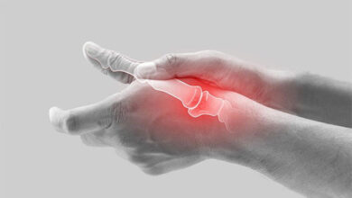 de quervains tendinosis 3