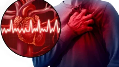 سکته قلبی چه علائمی دارد؟